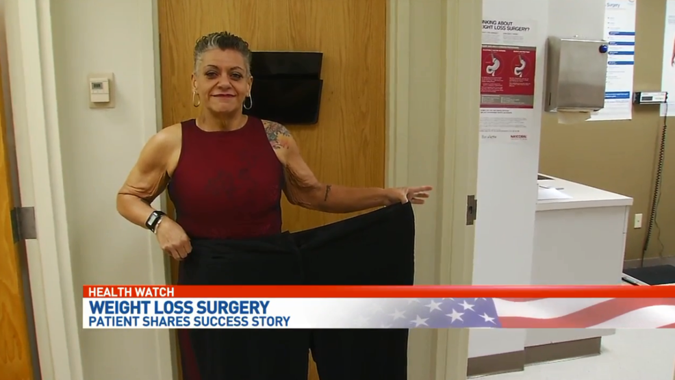 Patients share weight loss surgery success stories WEAR