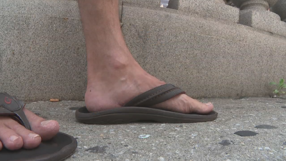 Flipflops are popular but can be dangerous WBFF