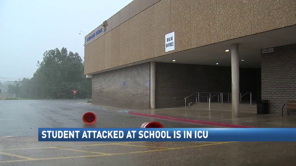Mobile student in ICU after being attacked at Baker High School WPMI