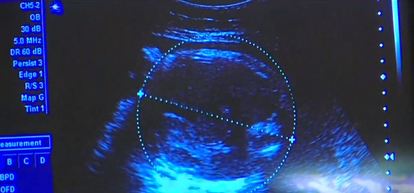 Could Utah Be The Next State To Pass A Heartbeat Abortion Law Kutv could utah be the next state to pass a heartbeat abortion law kutv